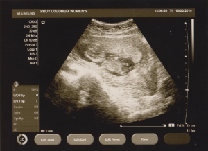 ultrasound 2014-10-23 4.jpg